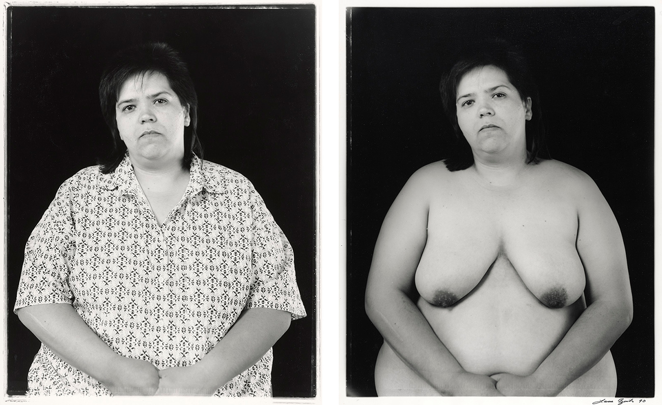 Left: Photo of top portion of clothed woman; right: photo of top portion of same woman unclothed.