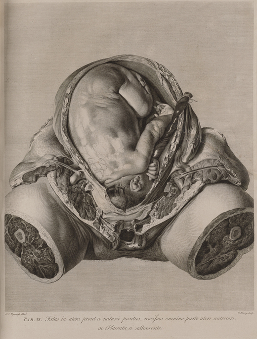 Foetus in utero, Robert Strange, after Jan van Rymsdyk, engraving. From William Hunter, Anatomia uteri humani gravidi tabulis illustrata = The Anatomy of the Human Gravid Uterus Exhibited in Figures (Birmingham: John Baskerville, 1774), pl. 6. Los Angeles, UCLA Library Special Collections, Charles E. Young Research Library, BELT***RG520.H9 Image of a torso with legs and upper body removed, revealing cross sections of the legs. The skin and fat are pulled back over the pregnant stomach to reveal a detailed image of a fetus at full gestational age, head down.